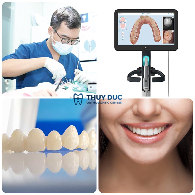 7. Mách bạn địa chỉ bọc răng sứ bền, chất lượng 1