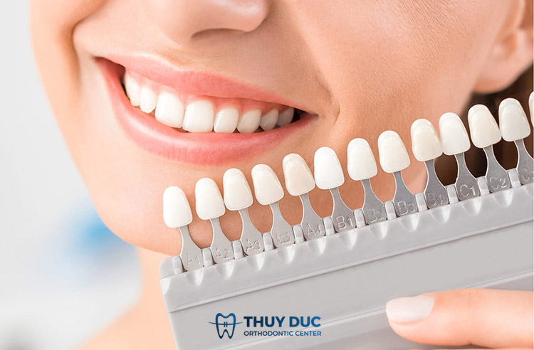 Bước 4: Kiểm tra và tiến hành gắn răng sứ 1 Bước 4: Kiểm tra và tiến hành gắn răng sứ 1