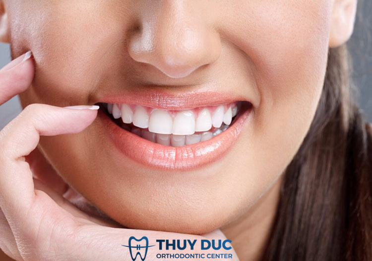 7. Bọc răng sứ nguyên hàm bao nhiêu tiền? 1 7. Bọc răng sứ nguyên hàm bao nhiêu tiền? 1