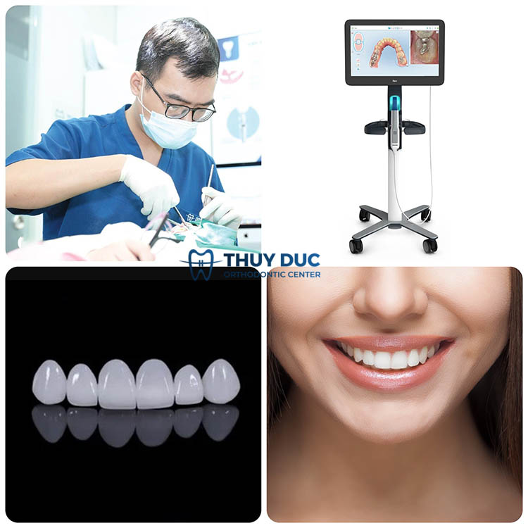 Bọc răng sứ an toàn, chất lượng tại nha khoa Thúy Đức 1 Bọc răng sứ an toàn, chất lượng tại nha khoa Thúy Đức 1