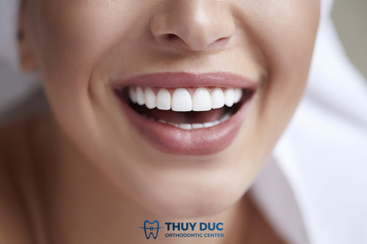 2. Bọc răng sứ nguyên hàm có ảnh hưởng gì không? 1 2. Bọc răng sứ nguyên hàm có ảnh hưởng gì không? 1