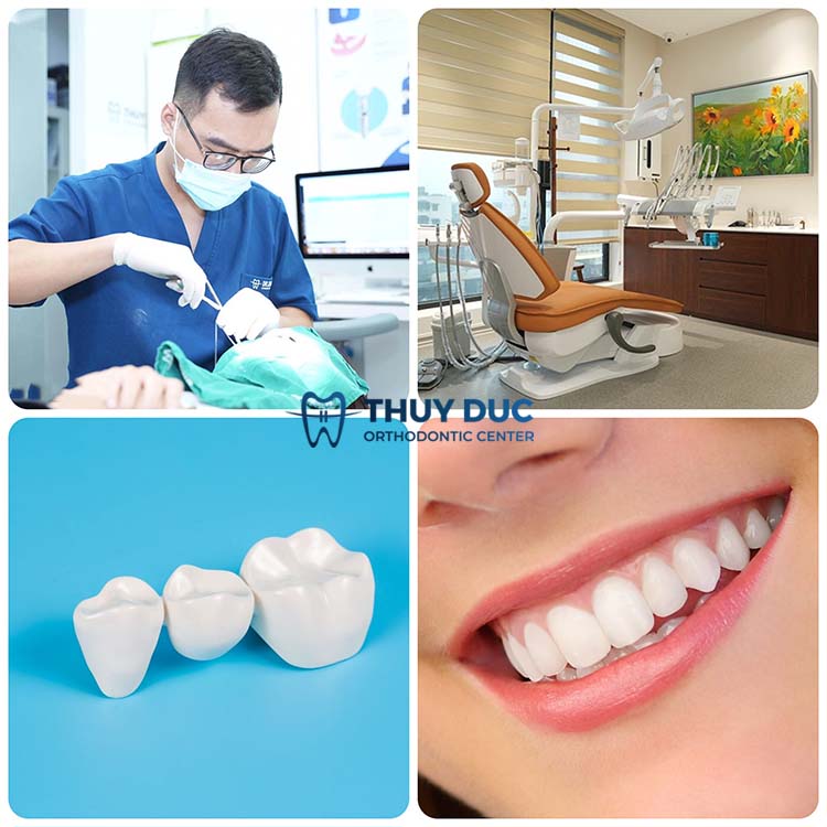 6. Địa chỉ bọc sứ cho răng khểnh uy tín, chất lượng 1