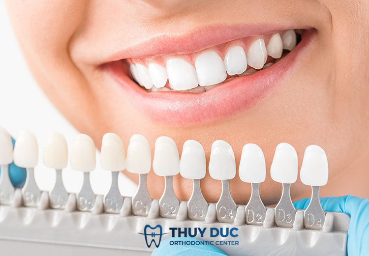 3. Bọc sứ răng khểnh có ảnh hưởng gì không? 1