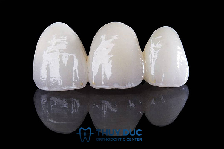 2. Răng sứ Emax có những loại nào? 1 2. Răng sứ Emax có những loại nào? 1