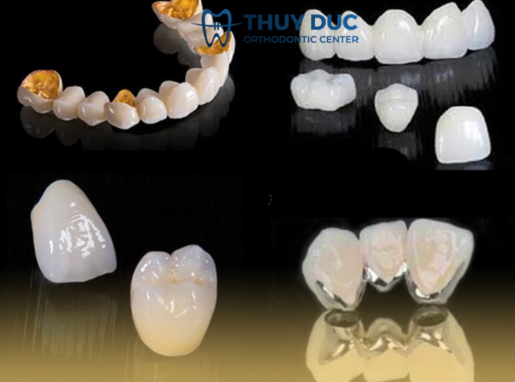 Các loại răng sứ hiện nay 1