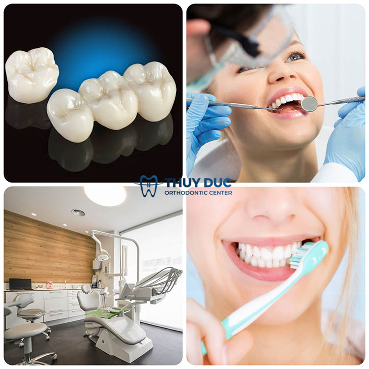 3. Độ bền của răng sứ phụ thuộc vào yếu tố nào? 1