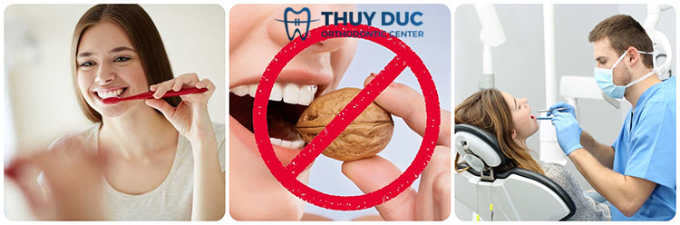 6. Hướng dẫn cách duy trì độ bền của răng sứ 1