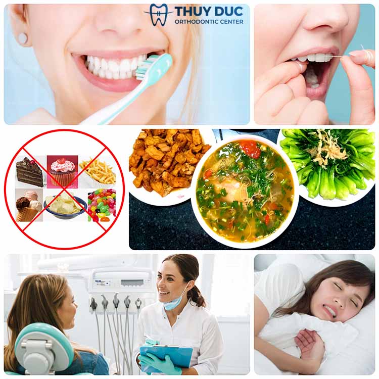 6. Cách chăm sóc răng sứ Emax bền đẹp nhất 1 6. Cách chăm sóc răng sứ Emax bền đẹp nhất 1