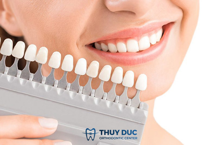 4. Vậy dán răng sứ hay bọc răng sứ tốt hơn? 1 4. Vậy dán răng sứ hay bọc răng sứ tốt hơn? 1