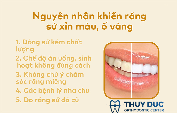 Nguyên nhân khiến răng bọc sứ xỉn màu, ố vàng 1 Nguyên nhân khiến răng bọc sứ xỉn màu, ố vàng 1