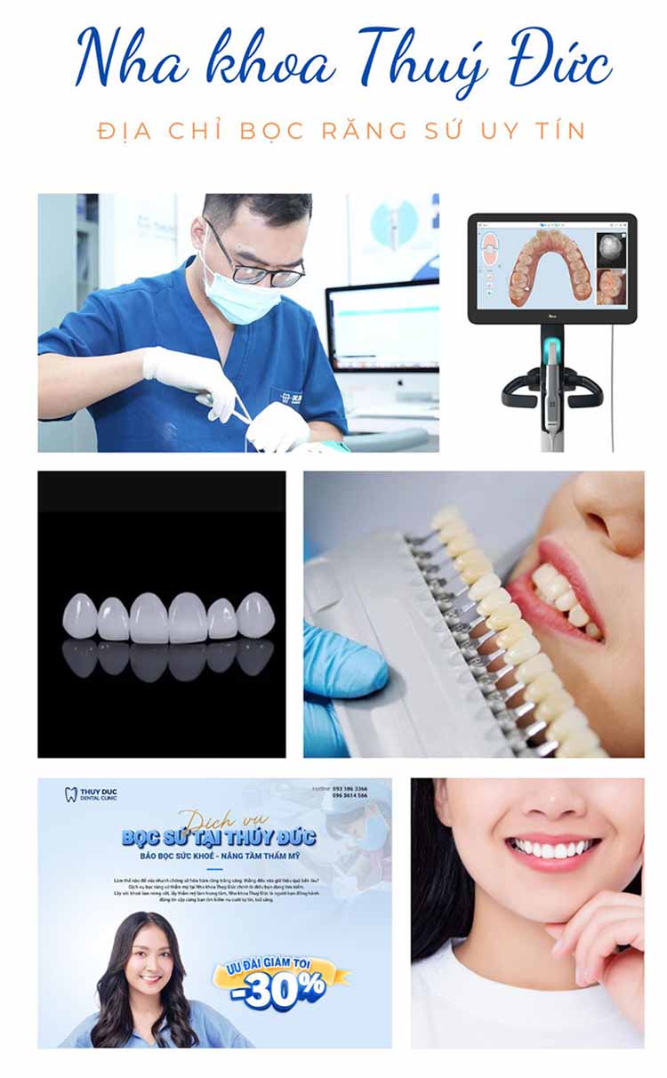 8. Mách bạn địa chỉ bọc răng sứ uy tín tại Hà Nội 1