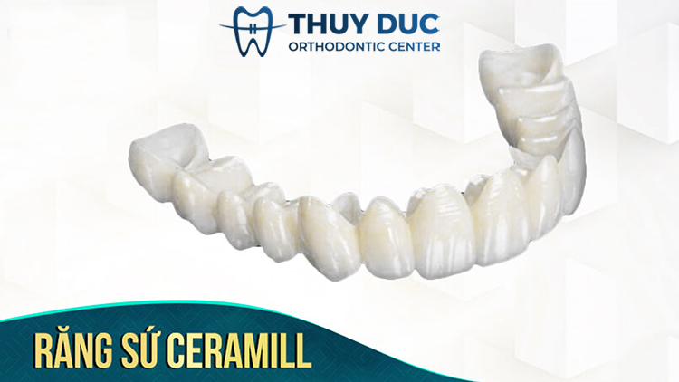 Răng sứ CERAMILL 1