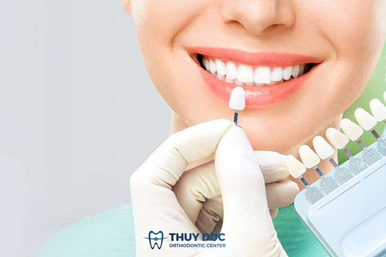 Dán Veneer 1 Dán Veneer 1