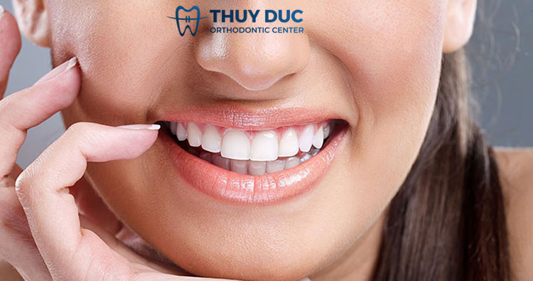 1. Răng sứ Emax là gì? 1 1. Răng sứ Emax là gì? 1