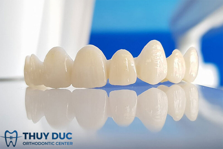 Bọc răng sứ cho 2 răng cửa bị hô nên chọn loại sứ nào? 1 Bọc răng sứ cho 2 răng cửa bị hô nên chọn loại sứ nào? 1