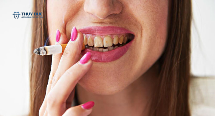 Do chế độ ăn uống 1 Do chế độ ăn uống 1