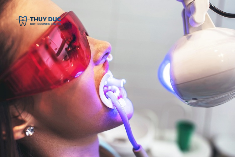 Tẩy trắng răng tại nha khoa 1