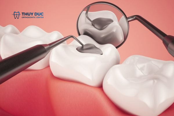 Điều trị bệnh thiếu sản men răng như thế nào? 1