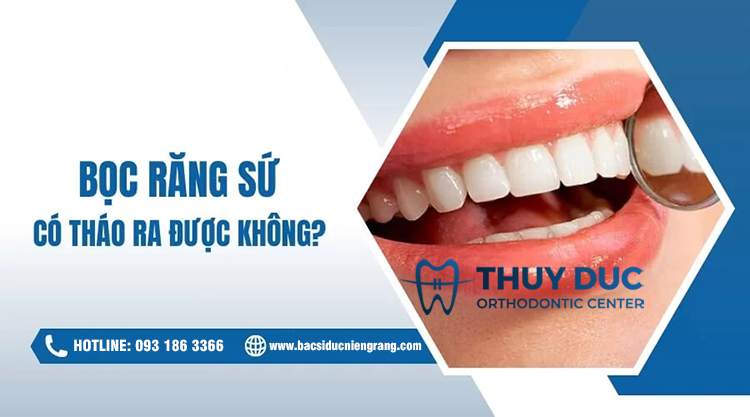Bọc răng sứ có tháo ra được không? 1 Bọc răng sứ có tháo ra được không? 1