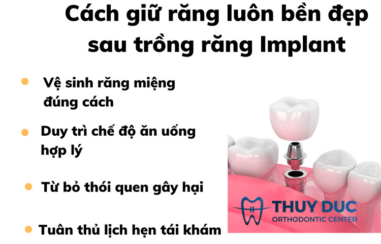 Cách giữ răng luôn bền khỏe sau khi trồng Implant 1 Cách giữ răng luôn bền khỏe sau khi trồng Implant 1