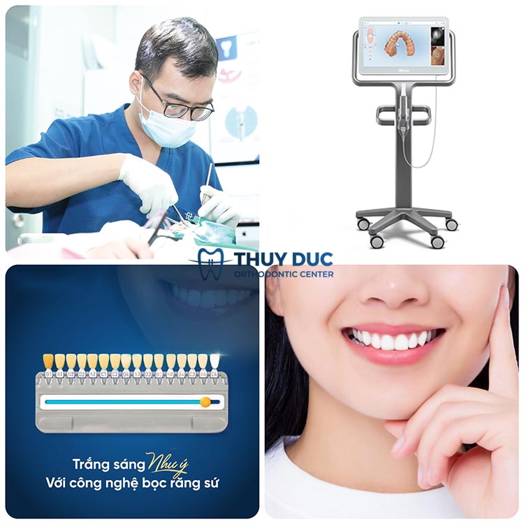 8. Địa chỉ lấy tuỷ bọc răng sứ uy tín tại Hà Nội 1 8. Địa chỉ lấy tuỷ bọc răng sứ uy tín tại Hà Nội 1