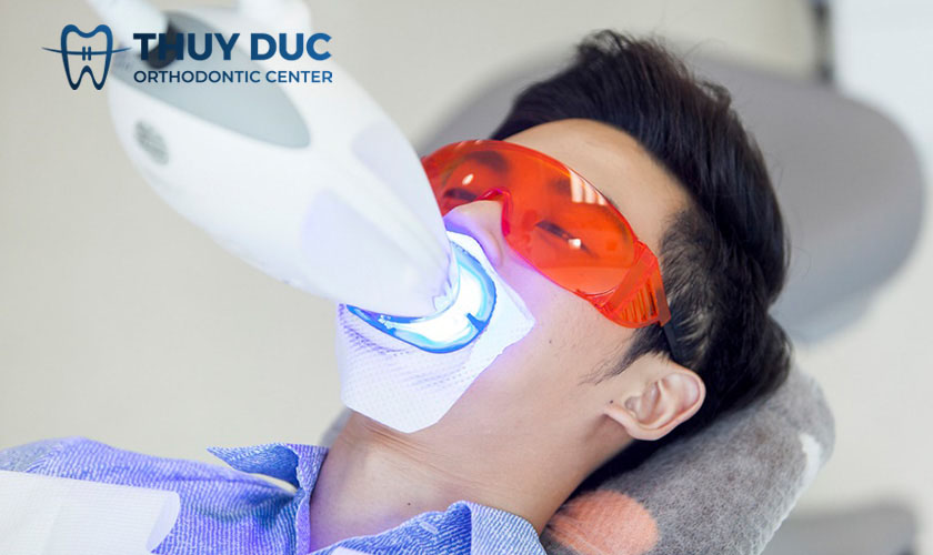 Tẩy trắng răng có ảnh hưởng đến men răng không? 1