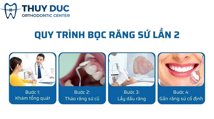 Quy trình tháo và bọc lại răng sứ đúng chuẩn 1 Quy trình tháo và bọc lại răng sứ đúng chuẩn 1
