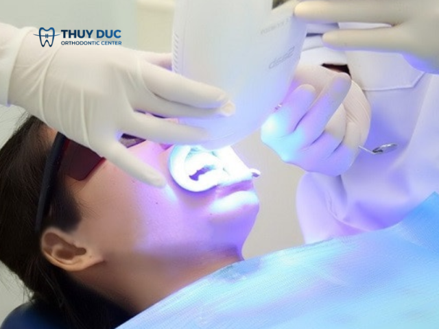 Tẩy trắng tại các cơ sở uy tín 1 Tẩy trắng tại các cơ sở uy tín 1