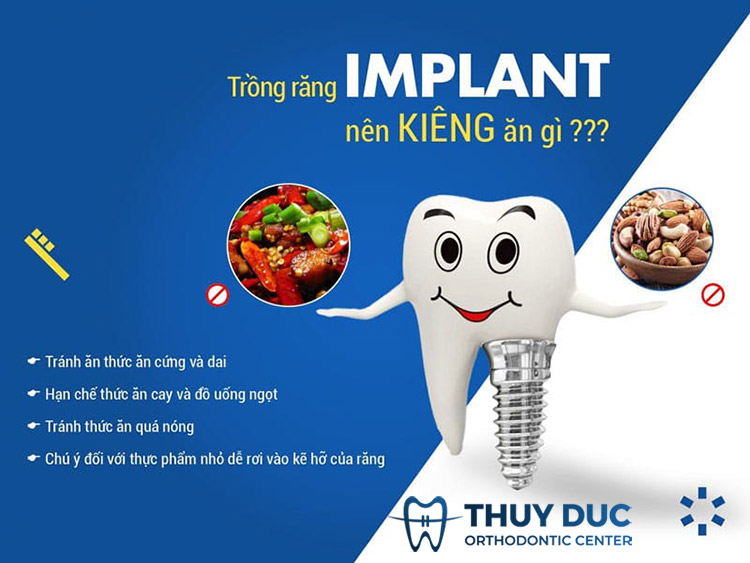 Trồng răng Implant nên kiêng gì? 1 Trồng răng Implant nên kiêng gì? 1