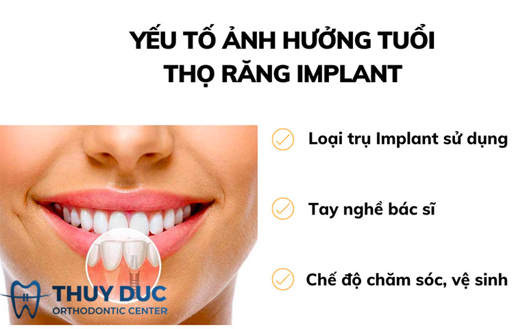 Yếu tố giúp tăng độ bền của răng Implant 1 Yếu tố giúp tăng độ bền của răng Implant 1