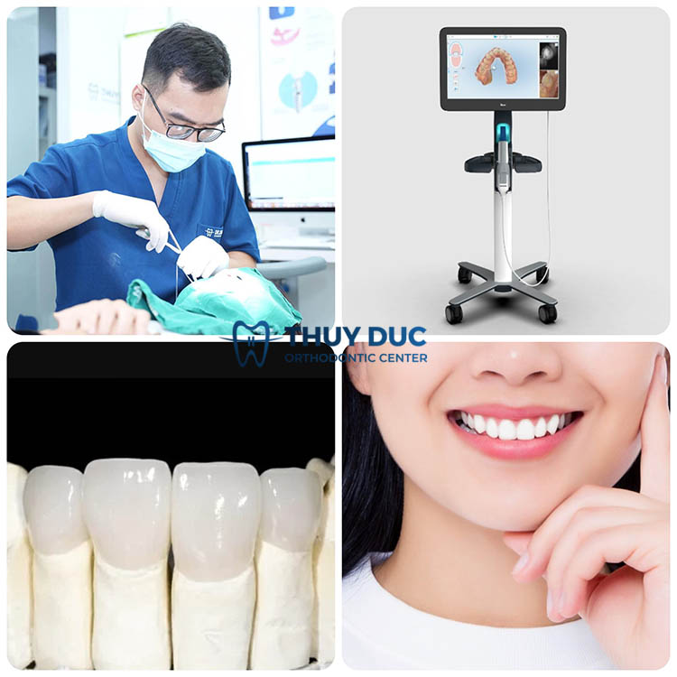 7. Mách bạn địa chỉ bọc răng sứ Venus chất lượng 1 7. Mách bạn địa chỉ bọc răng sứ Venus chất lượng 1