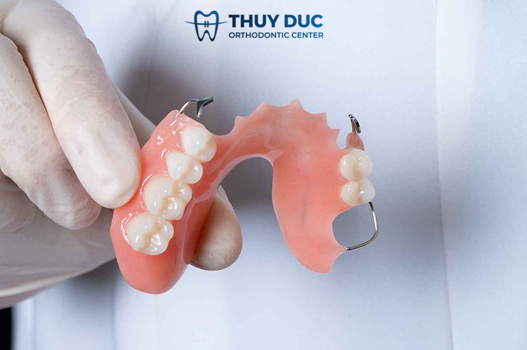 5. Chi phí của trồng răng giả tháo lắp bao nhiêu? 1