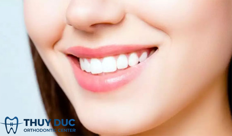 Vì sao cần chăm sóc răng miệng sau cấy ghép implant? 1 Vì sao cần chăm sóc răng miệng sau cấy ghép implant? 1