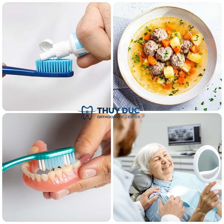 4. Những lưu ý khi thực hiện trồng răng giả tháo lắp 1 4. Những lưu ý khi thực hiện trồng răng giả tháo lắp 1