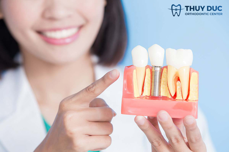 3. Trồng răng implant cho người già có nguy hiểm không? 1