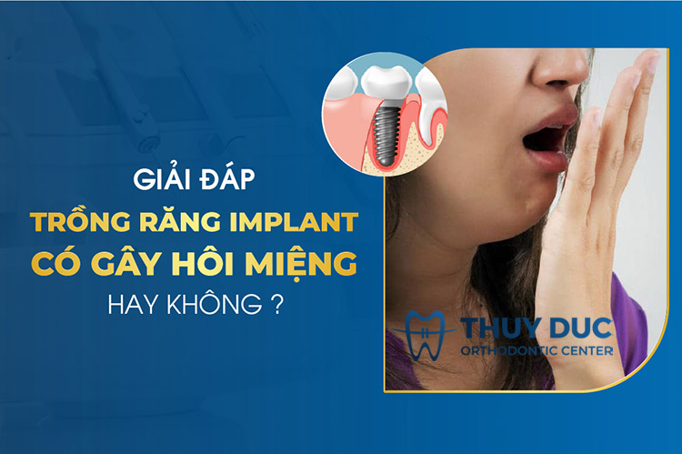 Trồng răng implant có bị hôi miệng không? 1