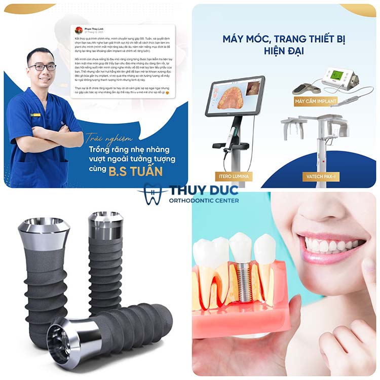 5. Địa chỉ trồng răng implant và cầu răng sứ chất lượng 1 5. Địa chỉ trồng răng implant và cầu răng sứ chất lượng 1