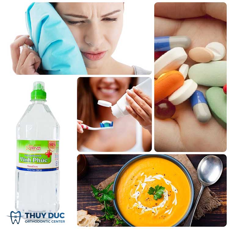 Hướng dẫn cách giảm ê buốt sau khi làm răng sứ 1 Hướng dẫn cách giảm ê buốt sau khi làm răng sứ 1