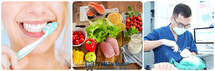 Hướng dẫn cách phòng ngừa bị buốt răng 1