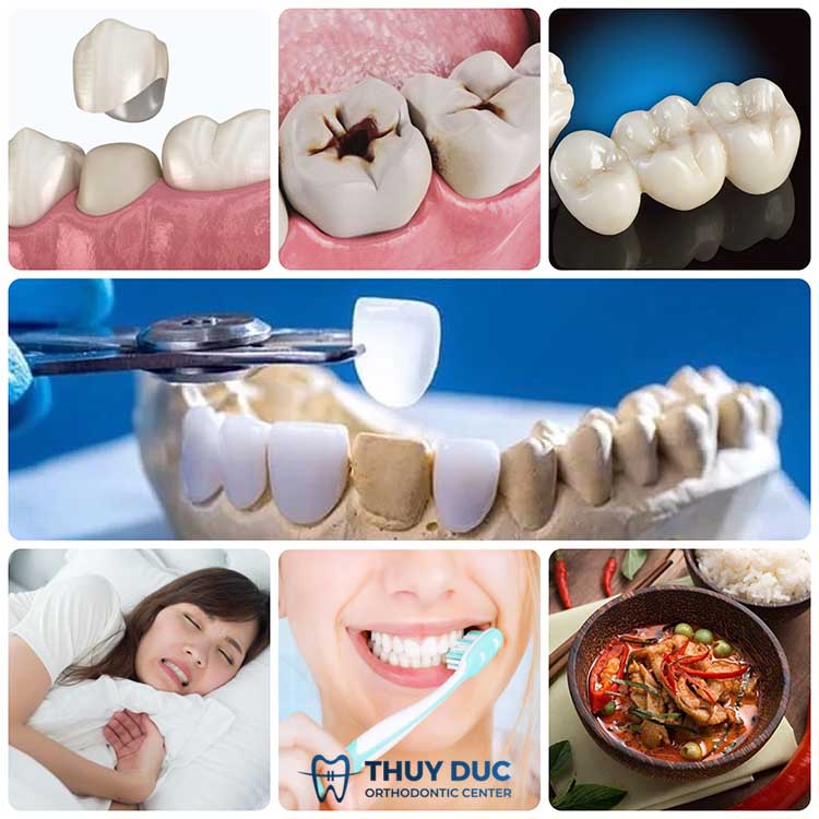 Vì sao sau khi làm răng sứ bị ê buốt? 1 Vì sao sau khi làm răng sứ bị ê buốt? 1