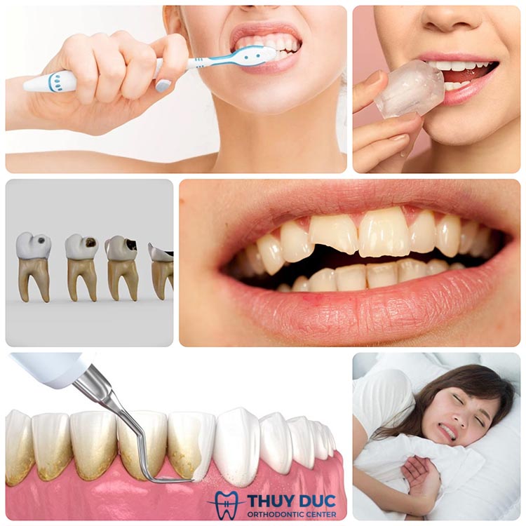 Tìm hiểu các nguyên nhân làm cho răng ê buốt 1