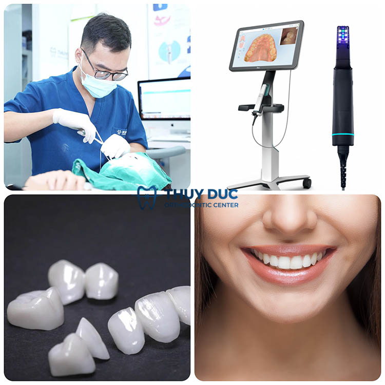 Mách bạn địa chỉ làm răng sứ chất lượng 1 Mách bạn địa chỉ làm răng sứ chất lượng 1