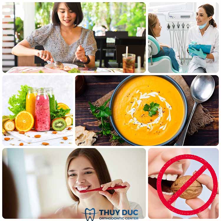 6. Những lưu ý quan trọng khi tiêm thuốc tê nhổ răng 1