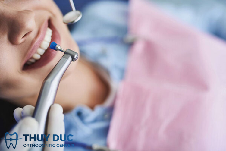 Bước 2: Đánh bóng răng 1 Bước 2: Đánh bóng răng 1