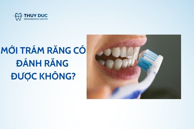 Mơ Thấy Gãy Răng Đánh Số Gì_ Cập Nhật Bí Mật Cùng Nhà Cái NA99 Để Trúng Lớn