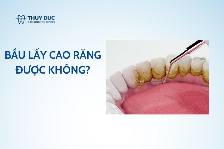 Bầu lấy cao răng được không? 1