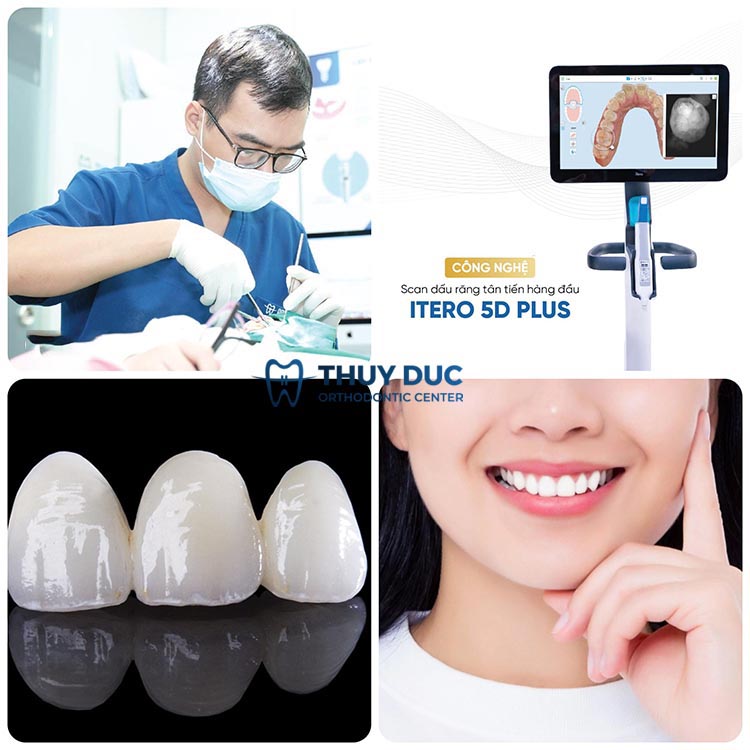 Nha khoa Thuý Đức- Địa chỉ bọc răng sứ uy tín, chất lượng 1 Nha khoa Thuý Đức- Địa chỉ bọc răng sứ uy tín, chất lượng 1