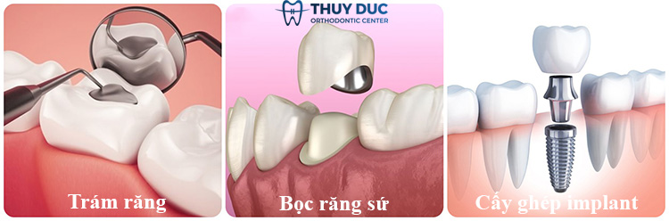 Điều trị tại nha khoa 1 Điều trị tại nha khoa 1