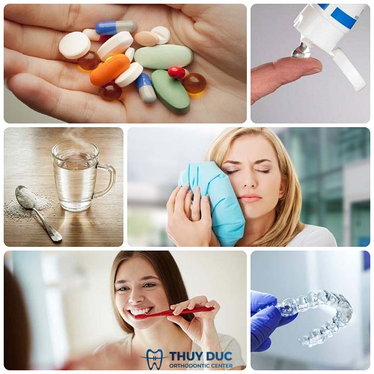 Cách giảm ê buốt sau khi mài răng xong tại nhà 1 Cách giảm ê buốt sau khi mài răng xong tại nhà 1