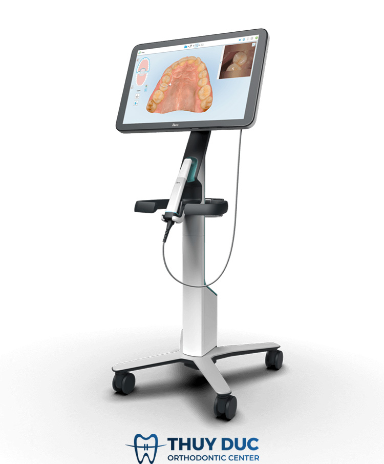 Địa chỉ niềng răng an toàn, chất lượng tại Hà Nội 2